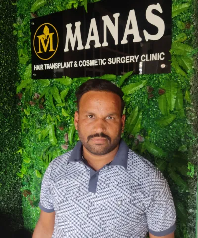 After Hair Transplant 3