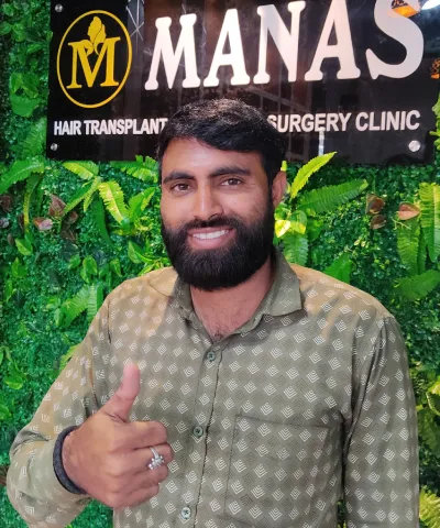 After Hair Transplant 5