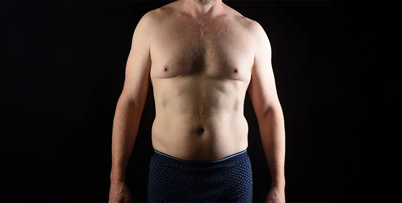 Gynaecomastia Surgery Service Banner