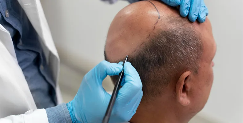 Hair Loss Treatment Service Banner