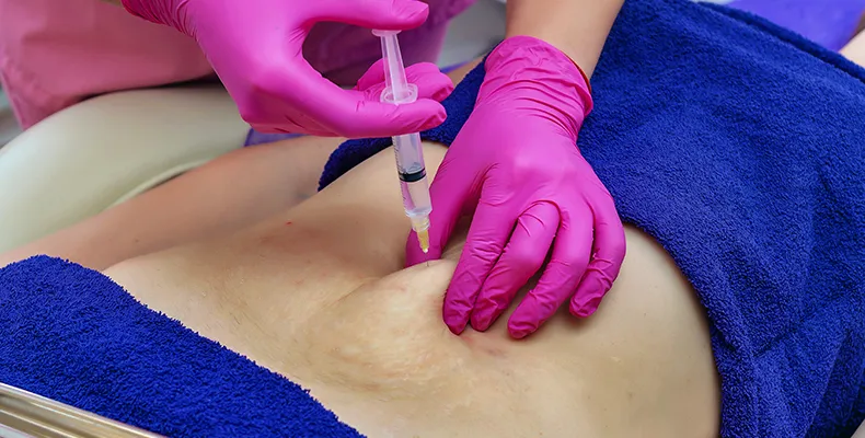 Stretch Marks Service Banner